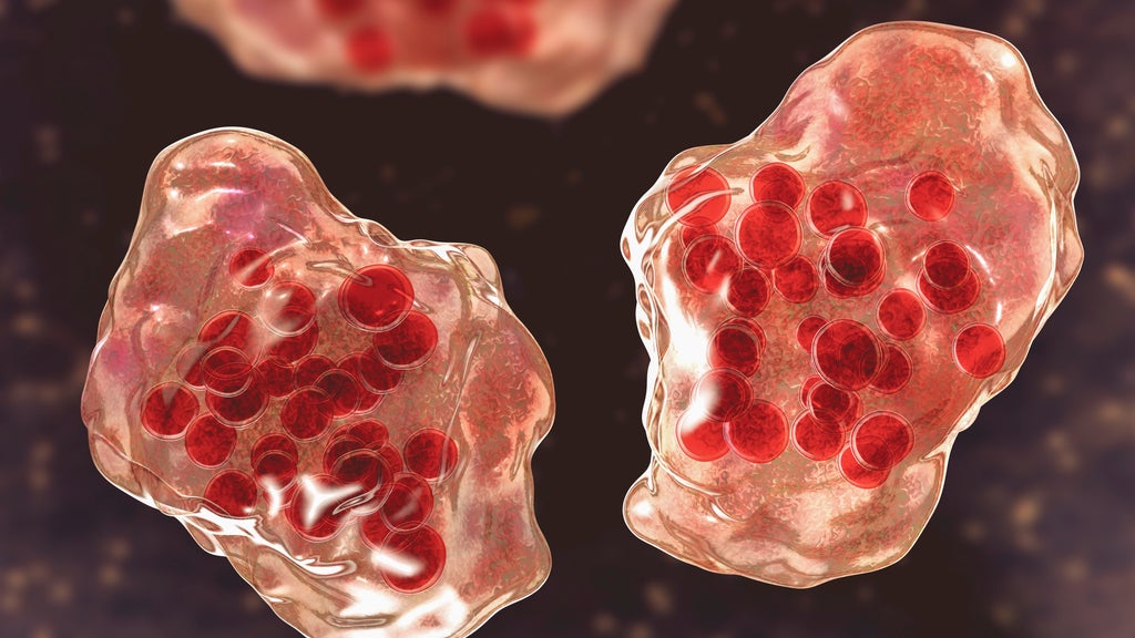 Central Minnesota county reports "several cases of suspected measles" — WCCO / CBS Minnesota, Eden Prairie Health news