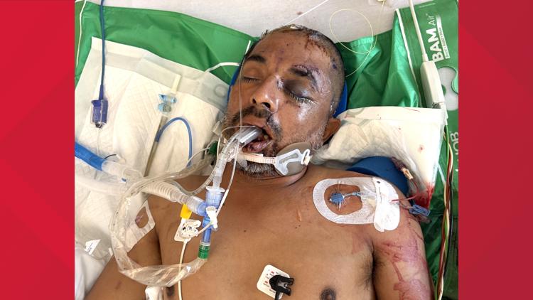 University Hospital asks for help identifying unconscious patient hit by truck Saturday evening — KENS 5 (San Antonio), Eden Prairie Health news