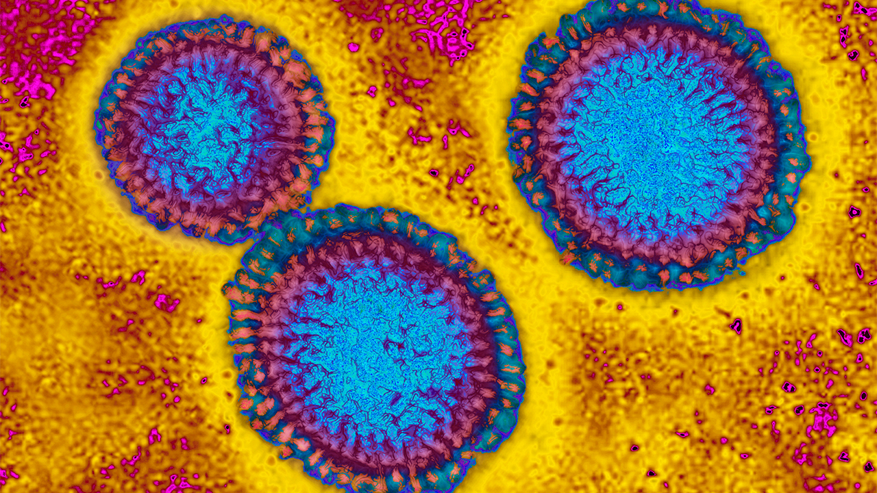Flu hospitalizations 'slightly higher' than usual, officials urge vaccinations — FOX 9, Eden Prairie Health news